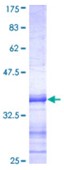 SDS-PAGE (HDAC5-4647H).jpg